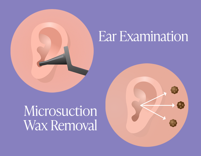 Ear Wax Removal Service